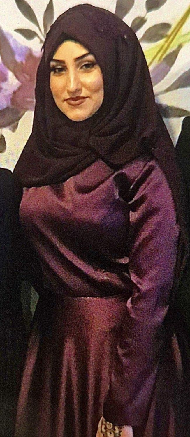 Click to view full size amazing hijab before and after lip lifting